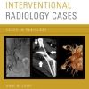 Interventional Radiology Cases