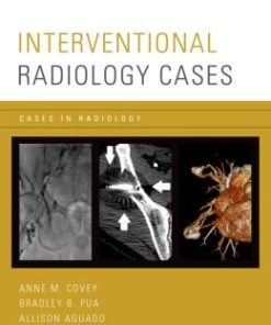 Interventional Radiology Cases