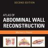 Atlas of Abdominal Wall Reconstruction, 2nd Edition (Videos, Organized)