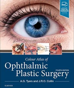 Colour Atlas of Ophthalmic Plastic Surgery, 4th Edition (Videos)