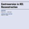 Controversies in ACL Reconstruction, An Issue of Clinics in Sports Medicine, 1e (The Clinics: Orthopedics) (PDF)