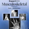 ExpertDDx: Musculoskeletal, 2nd Edition (PDF)