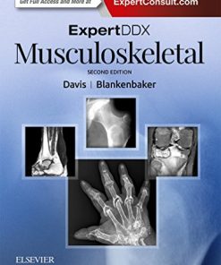 ExpertDDx: Musculoskeletal, 2nd Edition (PDF)