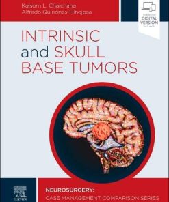 Intrinsic and Skull Base Tumors: Neurosurgery: Case Management Comparison Series (PDF)