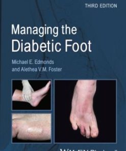 Managing the Diabetic Foot