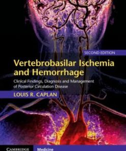 Vertebrobasilar Ischemia and Hemorrhage, 2nd Edition (PDF)