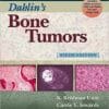 Dahlin’s Bone Tumors: General Aspects and Data on 10,165 Cases, 6th Edition (PDF)