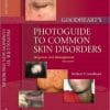 Goodheart’s Photoguide to Common Skin Disorders: Diagnosis and Management, 3rd Edition (PDF)