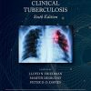 Clinical Tuberculosis, 6th Edition (PDF)