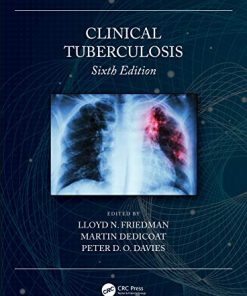 Clinical Tuberculosis, 6th Edition (PDF)