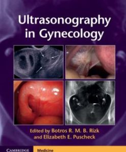 Ultrasonography in Gynecology