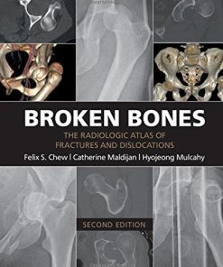 Broken Bones: The Radiologic Atlas of Fractures and Dislocations