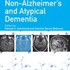 Non-Alzheimer’s and Atypical Dementia