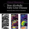 Clinical Dilemmas in Non-Alcoholic Fatty Liver Disease