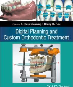 Digital Planning and Custom Orthodontic Treatment (EPUB)