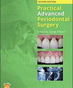 Practical Advanced Periodontal Surgery, 2nd Edition (EPUB)