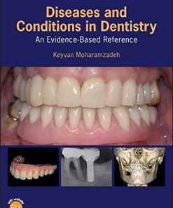 Diseases and Conditions in Dentistry: An Evidence-Based Reference (PDF)