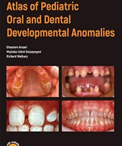 Atlas of Pediatric Oral and Dental Developmental Anomalies (EPUB)