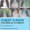 Chest X-Rays for Medical Students: CXRs Made Easy, 2nd Edition