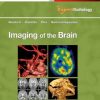 Imaging of the Brain: Expert Radiology Series (PDF)