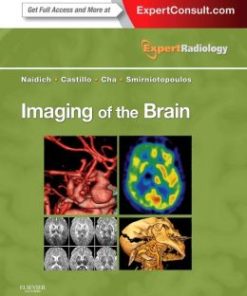 Imaging of the Brain: Expert Radiology Series (PDF)