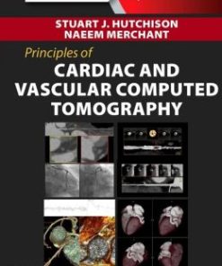 Principles of Cardiac and Vascular Computed Tomography (EPUB)