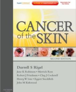 Cancer of the Skin, 2nd Edition