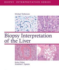 Biopsy Interpretation of the Liver (PDF)