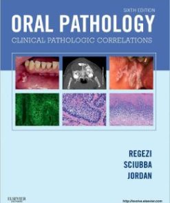 Oral Pathology: Clinical Pathologic Correlations, 6th Edition