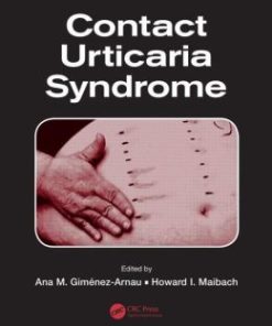 Contact Urticaria Syndrome