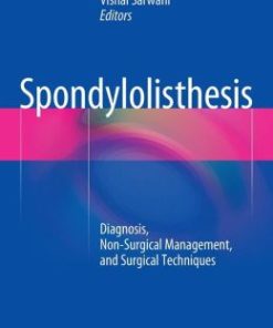 Spondylolisthesis: Diagnosis, Non-Surgical Management, and Surgical Techniques (EPUB)