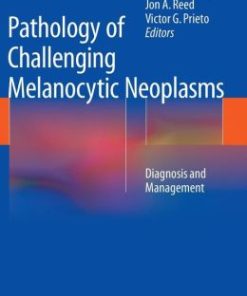 Pathology of Challenging Melanocytic Neoplasms: Diagnosis and Management (PDF)