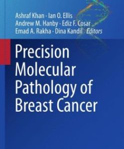 Precision Molecular Pathology of Breast Cancer (PDF)