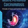 Gastric Peritoneal Carcinomatosis: Principles of Surgery and Treatment Options (PDF)