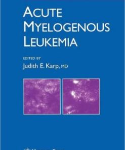 Acute Myelogenous Leukemia (PDF)