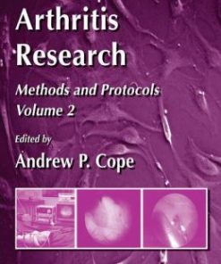 Arthritis Research: Volume 2: Methods and Protocols (EPUB)