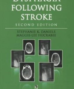 Dysphagia Following Stroke, 2nd Edition