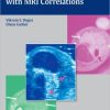 Musculoskeletal Ultrasound with MRI Correlations (PDF)