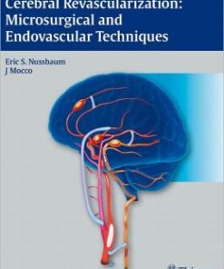 Cerebral Revascularization: Microsurgical and Endovascular Techniques (PDF)