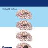 The Glioma Book (Original PDF + Videos)