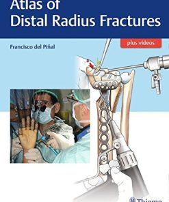 Atlas of Distal Radius Fractures 1st edition (PDF)