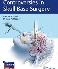 Controversies in Skull Base Surgery (PDF)