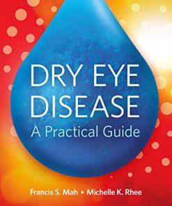 Dry Eye Disease: A Practical Guide