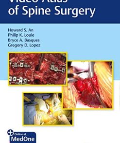 Video Atlas of Spine Surgery (PDF Book+Videos)