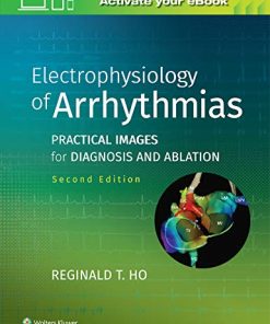 Electrophysiology of Arrhythmias: Practical Images for Diagnosis and Ablation, 2nd Edition (EPUB)