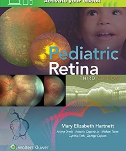 Pediatric Retina, 3ed (ePub+azw3+Converted PDF)