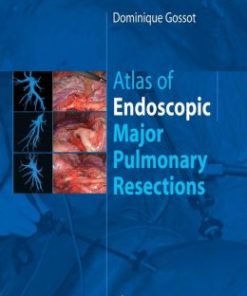 Atlas of endoscopic major pulmonary resections (PDF)