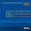 Atlas of electroencephalography:The Epilepsies. EEG and epileptic syndromes Vol 2 (ePub+Converted PDF)