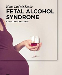 Fetal Alcohol Syndrome (EPUB)