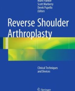 Reverse Shoulder Arthroplasty: Biomechanics, Clinical Techniques, and Current Technologies